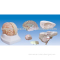 The model of brain shape and right semi sides of brain vas